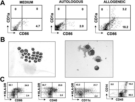Figure 3. Morphologic and immunophenotypic characteristics of CD34+ cells stimulated by allogeneic T cells. (A) Freshly isolated CB CD34+ cells were mixed with irradiated autologous CB (AUTOLOGOUS) or allogeneic blood (ALLOGENEIC) T cells at a 1:2 S/R ratio, or with medium alone (MEDIUM), for 6 days and then were analyzed for CD86 and CD1a expression by flow cytometry. The proportion of positive cells is shown in each quadrant. This result is representative of 3 separate experiments. (B) Cytospins of freshly isolated CB CD34+ cells (left), or CB CD34+ cells that had been in culture with allogeneic T cells for 6 days and then separated on ficoll-gradient (right), were stained with May-Grünwald-Giemsa. Images were visualized under an Axioskop 2 microscope equipped with a 63 ×/1.4 oil-immersion objective lens (Zeiss, Thornwood, NY). Images were captured with a Zeiss Axiocam camera and Zeiss Axiovision software version 3.1, and processed with Adobe Photoshop 5.5 software (Adobe Systems, San Jose, CA). (C) The phenotypic expression of markers such as HLA-DR, CD86, CD40, CD14, and CD11c was evaluated in CD34+ cell-derived APCs obtained after culture with allogeneic T cells. The proportion of positive cells is shown in each quadrant. The results are representative of 3 separate experiments.