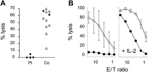 Figure 2. Impaired NK cytotoxicity. (A) Pooled data from 4 independent NK cytotoxicity assays from the patient (•) and controls (▵) including both parents and 2 patients with HPS of unknown genetic cause (▴). K562 cells were used as targets; spontaneous lysis was less than 18% in all assays. (B) NK cytotoxicity using PBMCs ex vivo or after 7-day stimulation with IL-2 from the patient and mean plus or minus standard deviation of 5 controls, including both parents.