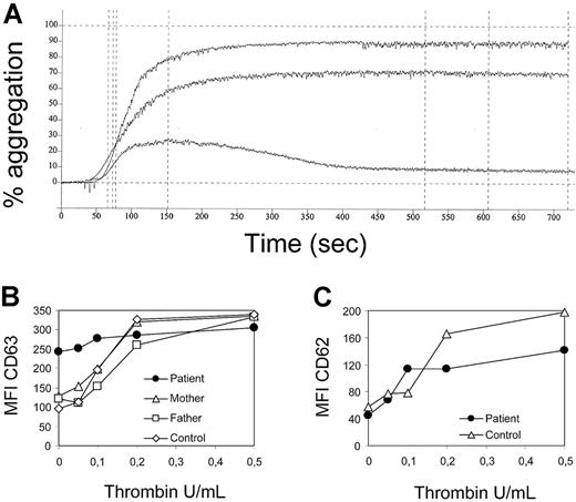 Figure 6. Impaired platelet aggregation and degranulation. (A) Platelet aggregation after stimulation with ADP from the patient (bottom line) and 2 healthy controls (top lines). (B) Degranulation of activated platelets assessed by CD63 expression. The data show the mean fluorescence intensity (MFI) of anti-CD63-stained unstimulated or thrombin-stimulated platelets from the patient and 3 controls, including both parents. (C) Baseline expression of CD62 and up-regulation upon activation with the indicated concentrations of thrombin.