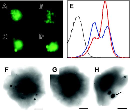 Figure 7. Reduction, abnormal size, and distribution of platelet-dense granules. (A-D) Mepacrine staining of platelets from a healthy control (A-B) and the patient (C-D). Representative staining patterns are shown. (E) Fluorescence histograms of mepacrine-stained platelets from the patient (blue) and a healthy control (red). Unstained platelets from the patient are shown in gray. (F-H) Whole-mount electron microscopy of representative platelets from a control (F) and the patient (G-H). Granules were present in 41% of the patient's platelets.