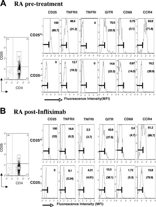 Figure 5. Phenotype of CD4+CD25hi Tregs from RA patients. (A) Purified CD4+ T cells were stained with anti-CD4 Cychrome and anti-CD25 PE and the population was sorted into CD4+CD25- and CD4+CD25hi subsets as indicated in “Patients, materials, and methods.” The resultant purity of CD4+CD25hi and CD4+CD25- T cells is shown. Purified populations were stained with anti-TNFRI-FITC-, anti-TNFRII-APC-, anti-GITR-FITC-, anti-CD69-FITC-, and anti-CCR4-APC-conjugated mAb as indicated. (B) Anti-TNF therapy down-regulates expression of TNFRII and GITR on CD4+CD25hi T cells. Freshly sorted CD4+CD25hi T-regulatory cells and CD4+CD25- effector cells were isolated from 15 RA patients treated with infliximab and their phenotype was characterized. Numbers in each box indicate the percentages of positive cells and those in parentheses, the mean fluorescence intensity of the stained cells. These changes in phenotype were compared with the phenotype of healthy donors, shown in Figure 1.