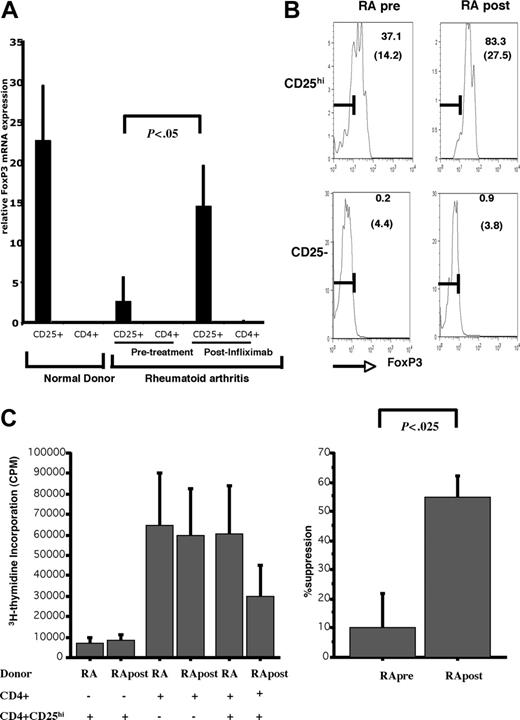 Figure 8. CD4+CD25hi Tregs from RA patients recover their suppressive function after infliximab therapy. (A) FOXP3 mRNA expression is reduced in CD4+CD25hi Tregs of patients with active RA and recovers following treatment with infliximab. CD4+CD25- and CD4+CD25hi T cells were sorted as described from RA patients before (RA pre) and after (RA post) treatment with infliximab. Real-time PCR was carried out in triplicate for FOXP3 mRNA and relative fold changes were normalized to GAPDH. Data represent the mean ± SEM of 5 different experiments. The same RA patients were examined following 3 months of therapy with infliximab. Following infliximab therapy, FOXP3 mRNA levels in CD4+CD25hi Tregs of RA patients were significantly increased (P = .05) and not significantly different from that found in healthy controls. (B) FoxP3 protein expression in CD4+CD25hi Tregs recovers after anti-TNF treatment of RA patients. CD4+CD25- and CD4+CD25hi T cells were sorted as described. Intracellular FoxP3 staining was carried out in CD4+CD25- and CD4+CD25hi T cells sorted from an RA patient before and after infliximab therapy. (C) CD4+CD25- responders (5 × 104/well) and CD4+CD25hi Tregs (5 × 104/well) were isolated from active RA patients before infliximab therapy and after 3 months of infliximab treatment. Cells were cultured with plate-bound anti-CD3 (1 μg/well) either alone or at a 1:1 ratio. After 72 hours, 3H-thymidine incorporation was determined. Data represent the mean ± SE of 15 RA patients before and after infliximab treatment.