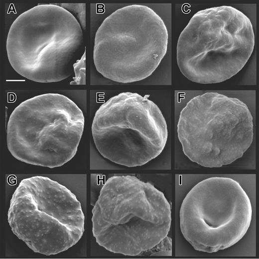 Figure 3. Surface characteristics of mutant cell lines expressing truncated versions of KAHRP. Scanning electron micrographs of (A) 3D7-K119, (B) 3D7-K245, (C) 3D7-K362, (D) 3D7-K405, (E) 3D7-K530, (F) 3D7-K589, (G) 3D7-K(re), (H) parental 3D7, and (I) KAHRP KO8 parasite lines. The bar represents 2 μm.