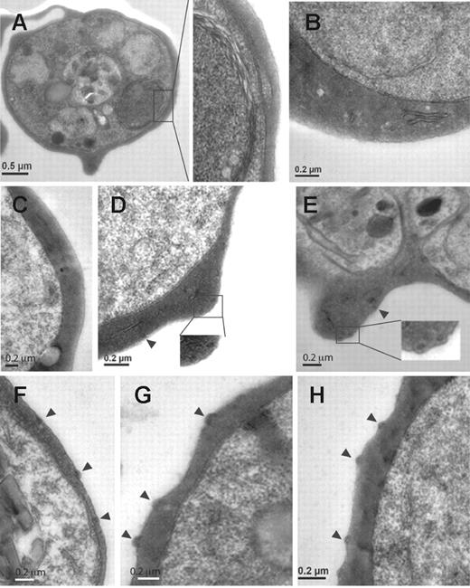 Figure 4. Ultrastructural features of knobs in KAHRP mutant cell lines. Transmission electron micrographs of erythrocytes infected with (A) 3D7-K119, (B) 3D7-K245, (C) 3D7-K362, (D) 3D7-K405, (E) 3D7-K530, (F) 3D7-K589, (G) 3D7-K(re), and (H) 3D7 (parental strain). Arrowheads indicate knob formation. Insets show a higher magnification of the areas of each cell shown in panels A, D, and E.