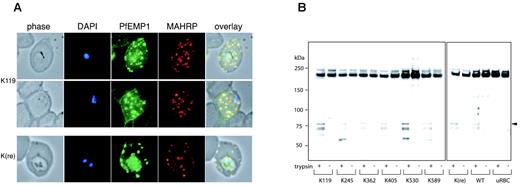 Figure 7. PfEMP1 trafficking and surface exposure on KAHRP mutant cell lines. (A) Immunofluorescence assay on 3D7-K119- and 3D7-K(re)-infected erythrocytes with anti-ATS antibody detecting PfEMP1 and anti-MAHRP, a Maurer clefts marker. The first panel in each row shows a phase-contrast image, the second panel is nuclear DNA stained with DAPI, the third panel is the reaction with the anti-ATS antibody for PfEMP1 detection, the fourth panel is the reaction with anti-MAHRP antibody, and the fifth panel illustrates an overlay of the previous 4 panels with colocalization shown in yellow. (B) Western blot analysis of trypsin treated (+) or untreated (-) intact erythrocytes infected with all mutant cell lines. The anti-ATS antibody detects cleaved PfEMP1 in case of presence of PfEMP1 on the surface in trypsin-treated samples (arrowhead). The full-length PfEMP1 runs at the same molecular weight as cross-reactive uRBC proteins.