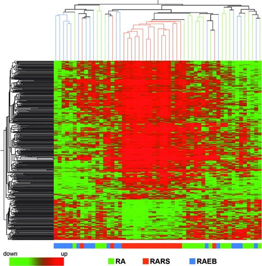 Figure 2. Hierarchical clustering of 457 differentially expressed genes in the patients with MDS with RA, RARS, and RAEB. Each row represents a single Affymetrix (or Affy) probe set. Each column represents a separate patient CD34+ sample.