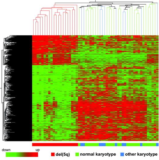 Figure 3. Hierarchical clustering of 889 differentially expressed genes in patients with MDS with a del(5q), patients with MDS with normal karyotype, and patients with MDS with other karyotypes. Each row represents a single Affy probe set. Each column represents a separate patient CD34+ sample.