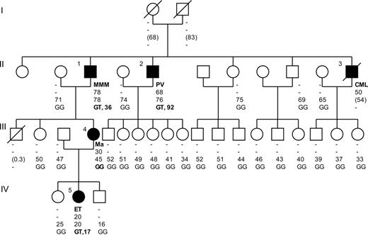 Figure 1. Genealogic tree of a large and complex family with MPD. Filled symbols indicate patients with MPD. Affected patients are numbered from 1 to 5. The type of MPD is reported on the first line under each symbol. The age at diagnosis and age at inclusion into the study (or at death in parentheses) are indicated on the second and third line, respectively. On the fourth line, the JAK2 genotype followed by the proportion, in percent, of mutant T allele is reported. - indicates not applicable; Ma, systemic mastocytosis; GG, wild-type JAK2 genotype; GT, heterozygous JAK2 genotype.