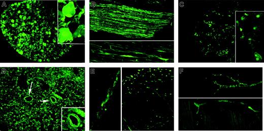 Figure 1. Sympathetic system t-PA/EGFP expressions. (A) Cervical ganglion section: expression confined to neuron cell bodies and axons (inset, ×100). (B) Sympathetic chain longitudinal section: discrete expression confined within individual axons. (C)Adrenal medulla section: chromaffin cell nuclei show prominent expression (inset, ×100); cortex negative. (D) Lung: positve cross-cut fibers, presumed axons, dot all regions of the interstitium. Few appear in bronchial arteriolar walls (arrows and inset). (E) Brain surface: axon showing positive expression is embedded in wall of anterior cerebral artery branch (left). Positive expression is also evident in cross-cut and full-length individual axons (right). (F) Axon terminals heart surface: prominent expression by typical intermittent varicosities in the walls of a branching coronary arteriole (above) and in myocardium (below). Magnifications are ×40, except as noted.