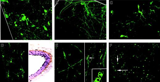 Figure 2. Vessel-wall t-PA/EGFP expression. (A) Aorta surface: 3D Z-axis composite of adventitial layers shows positve expression by a few discrete axons compatible with sparse innervation. (B) Carotid artery surface: 3D Z-axis composite of adventitial layers reveals positive expression by numerous postitve axons. (C) Renal artery surface: positive expression is confined to a fairly dense nerve net with prominent varicose dilations. (D) Mesenteric artery surface: numerous axons with bright terminal varicosities appear in deep adventitial layer (left). Section immunostained for t-PA shows dense subadventitial plexus on outer smooth-muscle surface (brown color; right). (E) Ear skin surface: positive expression appears confined to walls of branching arteriole, absent from numerous adjacent venules and capillaries. (F) Sciatic nerve section: expression is positive in walls of multiple nutrient vasa nervosa (arrows) and in scattered cross-cut axons. Magnifications are ×40, except as noted.