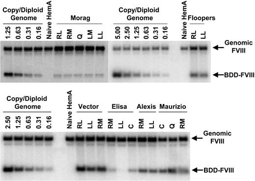 Figure 5. Comparable hepatic gene transfer efficiency by AAV2-cFVIII, AAV6-cFVIII, and AAV8-cFVIII in hemophilia A dogs. Southern blotting analysis for canine B-domain-deleted (BDD) FVIII transgene DNA in liver biopsies taken from multiple lobes in Morag and Floopers at 20 weeks, Vector at 102 weeks, Elisa at 177 weeks, Alexis at 77 weeks, and Maurizio at 49 weeks after vector injection. AAV-treated canine liver genomic DNAs yield 2 positive bands from BamHI digestion, representing the endogenous FVIII and transgene BDD-FVIII. The standards are generated with BamHI-digested plasmid DNAs spiked in liver genomic DNAs from naive hemophilia A dogs. RL indicates right lateral lobe; LL, left lateral lobe; RM, right medial lobe; LM, left medial lobe; Q, quadrate lobe; and C, caudate lobe.