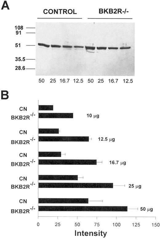 Figure 4. Angiotensin AT2 receptor antigen expression in the kidney. (A) Western blot of mouse kidney lysates for the AT2R receptor antigen. Kidney lysates from control and BKB2R-/- mice were prepared as indicated in “Materials and methods.” Equal amounts of total kidney lysate (12.5 μg to 50 μg) were added to each lane of the SDS-PAGE and, after electrophoresis, the gel contents were electroblotted onto nitrocellulose. An immunoblot was performed with anti-AT2R antisera followed by an antirabbit antibody conjugated with horseradish peroxidase. The protein was detected by the ECL system followed by an autoradiogram. The figure is a representative immunoblot experiment. (B) Densitometer scans were performed on multiple immunoblots of electrophoresed total kidney lysates from control and BKB2R-/- mice. The relative intensity of the bands was determined. The figure represents the mean plus or minus SEM of relative intensity of the bands of 3 or more experiments at each concentration of protein added. The data shown for 10 μg total kidney protein are the mean of only 2 experiments.