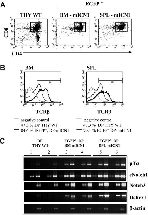 Figure 2. EGFP+CD4+CD8+ DP cells at the early phase of ICN1-induced leukemia overexpress TCR-β at the cell surface and present enhanced expression of Notch-signaling-related genes. (A) Three BALB/c wt mice underwent transplantation with ICN1-transduced bone marrow cells. Two weeks after BMT, cells were harvested, pooled, and sorted, as indicated by the square marker, to obtain purified EGFP+CD4+CD8+ cells from bone marrow and spleen of mICN1 donors (BM-mICN1 and SPL-mICN1, respectively). DP thymic cells sorted from sex- and age-matched wt mice were used as controls (THY WT). (B) Cells sorted as in panel A were stained for TCRβ expression at the cell surface: number indicates the percentage of TCRβ+ cells; data are representative of at least 3 independent experiments. (C) Semiquantitative RT-PCR of Notch-signaling-related genes (endogenous Notch1, as eNotch1; Notch3; Deltex1, and Ptcra as pTα) was performed on serial 1:5 dilutions of cDNA derived from cell lysates of pools sorted as in panel A. Numbers indicate different pools derived from each population by 2 independent experiments. PCR were normalized according to β-actin expression.