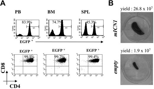 Figure 5. Phenotype o Rag2-/- mice at the late phase of ICN1-induced leukemia. (A) CD4 compared with CD8 FACS analysis was performed at 11 weeks after reconstitution for the detection of EGFP+ (top panels), and EGFP+CD4+CD8+ cells (bottom panels) in peripheral blood (PB), bone marrow (BM), and spleen (SPL) of Rag2-/- mice receiving syngeneic ICN1-transduced bone marrow. Rag2-/- control mice that underwent reconstitution with Rag2-/- bone marrow transduced with empty retrovirus and analyzed at the indicated time point do not contain EGFP+CD4+CD8+ cells in peripheral blood and organs (data not shown). (B) Macroscopic analysis and total yield of the spleen from the same animal described in panel A (top) and relative control mouse (bottom). Data are representative of at least 3 independent experiments.