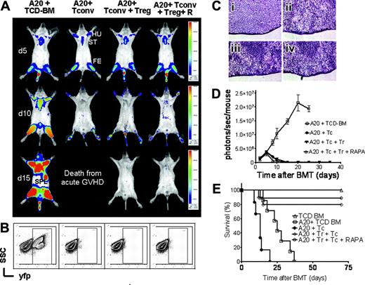 Figure 7. GVT effector function of TCONV cells is preserved in the presence of Treg cells and RAPA. Tumor growth and elimination are visualized by bioluminescence imaging (A), FACS analysis (B), histology (C), emitted photons over time (D), and survival (E). All Balb/c recipients (H-2kd) were given 1 × 105 A20 leukemia cells (H-2kd) and BMT was performed as described in “Materials and methods.” (A) luc+A20 tumor-cell localization at 5 days (top row), 10 days (middle row), and 15 days (bottom row) after BMT in representative animals given transplants with TCD-BM alone (first column from left), TCD-BM plus TCONV cells (second column from left), TCD-BM plus TCONV and Treg cells (third column from left), and TCD-BM plus TCONV and Treg cells and RAPA (fourth column from left). ST indicates sternum; HU, humerus; FE, femur; SPL, spleen. (B) Bone marrow samples with yfp+ A20 cells of recipients on day 12 after transplantation with TCD-BM alone (first column from left), TCD-BM plus TCONV cells (second column from left), TCD-BM plus TCONV and Treg cells (third column from left), and TCD-BM plus TCONV and Treg cells and rapamycin (fourth column from left). (C) H&E stains of representative spleen samples gathered on day 12 from animals receiving TCD-BM only (Ci), TCD-BM plus TCONV cells (Cii), TCD-BM plus TCONV and Treg cells (Ciii), and TCD-BM plus TCONV and Treg cells and RAPA (Civ). A homogenous leukemic infiltration is found only in animals receiving TCD-BM only (Ci) but not in the other groups. Microscopic evaluation was performed on a Nikon Eclipse TE 300 microscope equipped with 20 ×/0.45 and 40 ×/0.60 objective lenses (Nikon, Melville, NY). Photographs were captured by using a Spot digital camera (Diagnostic Instruments, Sterling Heights, MI). Digital images were saved as TIFF files, which were inserted into and processed with PowerPoint software (Microsoft, Redmond, WA). (D) Expansion of luc+A20 tumor cell as measured in photons over total body area (photons/second/mouse). Animals rejecting the A20 tumor demonstrate a rapid signal loss within the first 15 days after BMT. (E) Survival of BALB/c mice receiving TCD-BM alone (▵, n = 15), TCD-BM plus A20 leukemia cells (□, n = 15), TCD-BM plus A20 leukemia cells plus TCONV cells (•,n = 15), TCD-BM plus A20 leukemia cells plus TCONV and Treg cells (⋄,n = 12), or TCD-BM plus A20 leukemia cells plus TCONV and Treg cells and RAPA 0.5 mg/kg; ○,n = 12). Data from 3 independent experiments are combined.