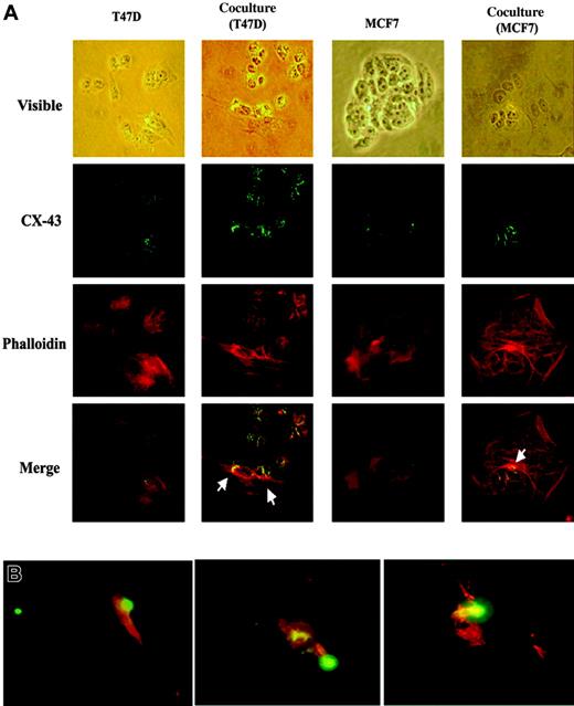 Figure 5. Gap junctions between BCCs and BM stroma. (A) T47D or MCF7 was cultured alone or as cocultures. Cultures were colabeled with CX-43 and the F-actin label, phalloidin. Figure shows representative labeling at magnification × 100. Cells shown in the top row (visible light) are presented as merged staining with anti–CX-43 and phalloidin on the bottom row. Arrows show CX-43 between BM stroma and BCCs. (B) Cocultures were established with the following modification: the BCCs were labeled with Vybrant CFDA SE cell tracer (green) and then added to BM stroma. After 24 hours, the cells were labeled with anti–CX-43 (red). Images were visualized, acquired, and processed as in Figure 3C, except that a 50 ×/0.9 NA objective was used.