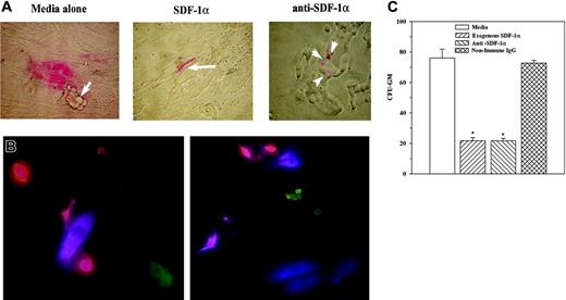 Figure 6. SDF-1α levels in hematopoietic regulation. (A) Cocultures were performed with T47D, ZR-75-30, DU4475, BT 483, or 2 primary BCCs from stage II BC (P1, P6). At 60% confluence, the following were added to cocultures: 102 PKH26-labeled CD34+/CD38–/Lin– cells and/or 0.1 ng/mL SDF-1α or 2 ng/mL anti–SDF-1α. At confluence, cells were examined microscopically; representative figures are shown. Arrows indicate location of BCCs. (B) Cocultures were established as described for panel A. At 10% to 20% confluence, PHK26-labeled CD34+/CD38–/Lin– cells were added, and after 16 hours the cells were studied by double immunofluorescence for stroma (APC/blue) and BCCs (FITC/green). Representative studies are shown for cocultures with T47D and stroma from 2 different donors. The cells were examined by fluorescence microscopy as for Figure 5B. (C) LTC-IC assays were performed in the presence or absence of 2 ng/mL anti–SDF-1α, 2 ng/mL nonimmune rabbit IgG, media alone, or 0.1 ng/mL SDF-1α. CFU-GM colonies are for 12-week cultures and are presented as the mean ± SD (n = 6). *P < .05 versus media alone or nonimmune IgG.