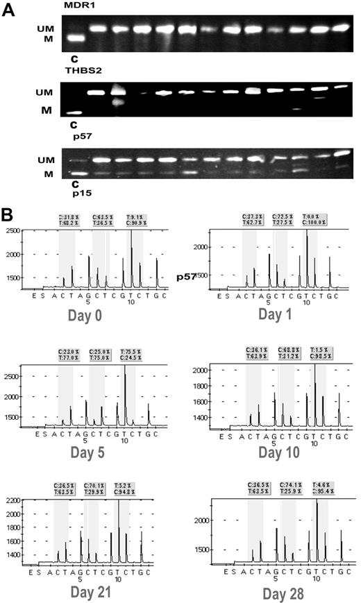 Figure 4. Examples of DNA methylation. (A) Pretreatment DNA methylation of MDR1, THBS2, and p57 using COBRA.20 Each lane represents a patient sample. UM indicates unmethylated; M, methylated; and C, methylated control. (B) Example of p15 methylation in a patient on days 0, 1, 5, 10, 21, and 28 of decitabine, VPA treatment. The 3 evaluated cytosines are enclosed in shaded squares. C indicates methylated cytosine; T, unmethylated site.