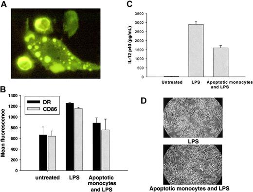 Figure 2. Phagocytosis of apoptotic monocytes induces immune paralysis in iDCs. (A) Apoptotic monocytes interacting with iDCs. Two DiI-stained apoptotic monocytes are surrounded by iDC pseudopods, and engulfed apoptotic fragments are seen within the dendritic cell (fluorescence microscopy, magnification × 100; further described under “Generation of monocyte-derived dendritic cells (DCs) and interaction with apoptotic monocytes”). For the micrograph in panel A, DiI-stained apoptotic cells were dried on a glass slide with Fluoromount-G (Southern Biotech), and then visualized under a Zeiss Axiovert 200 microscope equipped with a Plan-APOCHROMAT 100×/1.40 objective lens (Zeiss, Oberkochen, Germany). The image was captured with a SensiCam (PCO, Kelheim, Germany) and acquired via ImagePro Plus 4.5 software (Media Cybernetics, Silver Spring, MD). Final processing was performed with Adobe Photoshop 8.0 software (Adobe Systems, San Jose, CA). (B) Apoptotic monocyte engulfment down-regulates the expression of maturation-related molecules on DCs. Apoptotic monocytes were offered, or not offered, to iDCs at a ratio of 4:1. Five hours later, iDCs were exposed to 5 ng/mL LPS. HLA-DR-FITC and CD86 FITC expression was measured by flow cytometry. DR and CD86 are expressed at baseline levels in iDCs (mean fluorescence: 918 and 640, respectively) and are up-regulated following exposure to LPS (mean fluorescence: 1256 and 1159, respectively). Up-regulation by LPS is inhibited by exposure to apoptotic monocytes for both DR (mean fluorescence: 886, P < .001) and CD86 (mean fluorescence: 756, P < .01).Values represent the mean ± SEM of 3 experiments. (C) Apoptotic monocyte engulfment decreases IL-12 p40 production by DCs exposed to LPS. Immature DCs secrete IL-12 in response to LPS. Following interaction with apoptotic cells, down-regulation of IL-12 secretion is observed. Data represent the mean ± SD of 3 experiments. (D) Apoptotic monocytes prevent appearance of mature DC morphology in response to LPS. iDCs change morphology, becoming elongated and more “dendritic,” as they transform into mDCs in response to LPS. Following interaction with apoptotic cells, iDC morphology is retained despite exposure to LPS (light microscopy magnification, × 10). For the micrograph in panel D, cells were mounted in RPMI culture medium for visualization under a Nikon Eclipse TS100 microscope equipped with a Nikon Ph2 ADL 10×/0.25 objective lens (Nikon, Melville, NY). The image was then captured with a Nikon Coolpix 995 camera and processed with Adobe Photoshop 8.0 software.