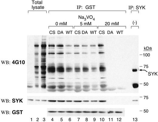 Figure 1. SYK is a substrate of PTPROt in vitro. GST fusion protein binding assays were carried out using GST-PTPROt-WT, -CS, or -DA proteins and pervanadate-treated lymphoma cell lysate. Bound proteins were washed with lysis buffer containing the indicated concentrations of sodium orthovanadate (0-20 mM). Thereafter, the remaining bound proteins were size fractionated, immunoblotted, and probed with the antiphosphotyrosine antibody 4G10 (top panel). The blot was stripped and reprobed with anti-SYK and anti-GST antibodies (middle and bottom panels). Lanes 1 to 3 are total lysates from untreated cells (lane 1, 25 μg protein) or pervanadate-treated cells (lane 2, 25 μg protein; lane 3, 50 μg protein). The last lane is an immunoprecipitation with anti-SYK antibody.