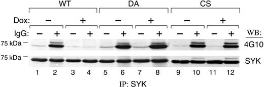 Figure 3. PTPROt inhibits SYK tyrosyl phosphorylation. Tet-inducible FLAG-tagged WT or mutant (DA and CS) PTPROt clones were cultured with or without Dox, serum starved, and stimulated thereafter with goat anti–human IgG (10 μg/mL) for 8 minutes or left untreated. Cells were lysed and immunoprecipitations were performed with anti-SYK antibody. The phosphorylation of SYK was detected by Western blot with the antiphosphotyrosine antibody 4G10 (top panel). The blot was then stripped and reprobed with anti-SYK (bottom panel).
