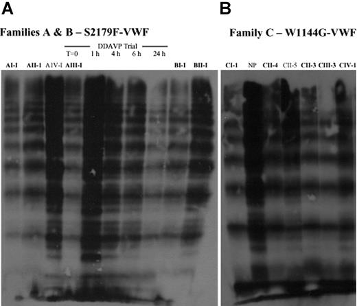 Figure 3. Plasma VWF multimer pattern obtained by high-resolution SDS-agarose gel electrophoresis for affected and unaffected family members. (A) Plasma VWF multimer distribution of members of families A and B. Affected family members harbor a S2179F VWF mutation and are denoted in bold type above each lane. Multimers in plasma from Patient AIII-1 were obtained before (T = 0) and at various time points after DDAVP administration. (B) Plasma VWF multimer distribution of members of family C. Affected family members harbor a W1144G VWF mutation and are denoted in bold type above each lane. At steady-state, VWF multimer satellite bands are nearly absent from the plasma of affected family members.