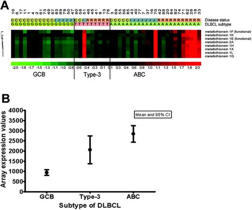 Figure 1. MT-I and MT-II expression in GCB, ACB, and type-3 subtypes of DLBCL. (A) MT-I and MT-II mRNA expression in 48 DLBCLs previously classified as GCB (n = 16), ABC (n = 23), and type-3 (n = 9) by expression profiling on Affymetrix arrays.15 For MT-I, the expression of 7 different isoforms represented on the Affymetrix 133A GeneChip is illustrated. C indicates complete remission; r, recurrent disease; and R, refractory disease. (B) MT-II mRNA expression values (arbitrary units) in the 3 different subtypes of DLBCL (GCB, ABC, type-3). CI indicates confidence interval.