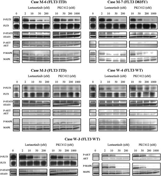 Figure 7. Inhibition of signaling downstream of FLT3, especially of STAT5, appears critical to achieving a cytotoxic response to lestaurtinib and PKC412. Western blot images showing the in vitro effects of lestaurtinib and PKC412 on FLT3 phosphorylation and phosphorylation of the downstream signaling proteins STAT5, AKT, and MAP kinase in MNCs following 1-hour exposure to a range of concentrations of each drug. Three of the 5 cases (M-6, M-7, and W-3) were in vitro cytotoxic responders to lestaurtinib, while 2 of the 5 cases (M-7 and W-3) were responsive to PKC412. MTS assay-derived cytotoxic IC50 concentrations for case-by-case comparison are shown in Table 2.