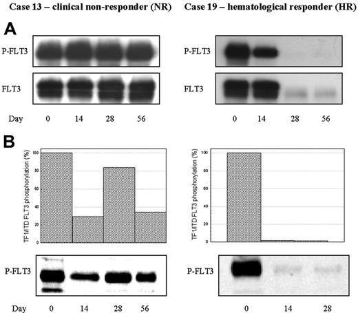 Figure 4. In vivo and ex vivo bioassay of FLT3 inhibition by lestaurtinib in 2 representative patients. (A) Direct in vivo bioassay. FLT3 was immunoprecipitated from BM MNCs, and sequential Western blot was performed using 4G10 antiphosphotyrosine antibodies and anti-FLT3 antibodies. (B) “Ex vivo” FLT3 PIA assay. TF/ITD cells were exposed to patient plasma obtained 12 hours after lestaurtinib administration on trial days 14, 28, and 56, then lysed and analyzed by sequential immunoblotting with 4G10 and anti-FLT3 antibodies. Densitometric analysis of phosphorylated FLT3, normalized for the amount of total FLT3, is displayed graphically. Patient 13, a FLT3 WT patient, made no clinical response to lestaurtinib, with direct assay revealing no evidence of in vivo FLT3 inhibition, and ex vivo assay confirming incomplete inhibition of TF/ITD FLT3 by patient plasma at all timepoints. In contrast, Patient 19, a clinically responsive patient with a FLT3 point mutation, showed significant in vivo reduction in FLT3 phosphorylation by day 14. Reductions in blast numbers limited the validity of the direct assay on days 28 and 56, by which time the FLT3 signal had become almost undetectable. Ex vivo assay, however, confirmed the presence of sufficient continuing FLT3 PIA on days 14 and 28 to almost fully inhibit TF1/ITD FLT3 phosphorylation.