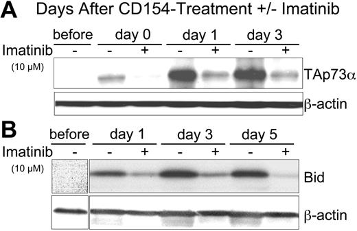 Figure 3. Imatinib inhibits the capacity of CD154 to induce CLL-cell expression of TAp73 α and Bid. (A) Cell lysates were prepared from CLL cells prior to culture (before) or at 0 (day 0), 1 (day 1), 3 (day 3), or 5 days (day 5) after 24-hour culture with HeLa-CD154 in media without (-) or with (+) 10 μM imatinib. Fifty micrograms of protein from each lysate was loaded onto separate lanes for PAGE and immunoblot analyses, as indicated at the top of each panel. Immunoblots were stained with antibodies specific for p73 (TAp73α) or β-actin (to control for protein loading), as indicated at the right of each immunoblot. (B) Immunoblots as in panel A were stained with antibodies specific for Bid or β-actin, as indicated at the right of each immunoblot.
