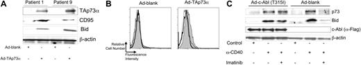 Figure 4. Imatinib inhibits the capacity to induce CLL-cell expression of Bid and CD95 except in CLL cells made to express imatinib-resistant mutant C-Ab. (A) CLL cells were transduced with an adenovirus encoding TAp73α (Ad-TAp73α) or lacking a transgene (Ad-blank), as indicated at the bottom of the panel. At 24 hours after the start of transduction, the CLL cells were isolated and cultured in fresh medium for another 48 hours. Cell lysates were prepared for immunoblot analyses using antibodies specific for p73 (TAp73α), CD95, Bid, or β-actin, as indicated on the right of each immunoblot. (B) CLL cells were transduced with an adenovirus expressing p73 (Ad-TAp73α) or with an adenovirus lacking transgene expression (Ad-blank) in the presence or absence of imatinib at 10 μM. After 48 hours the CLL cells were washed and cultured in fresh medium for another 24 hours and then examined for expression of surface CD95 by flow cytometry. Representative histograms show the expression of CD95 of Ad-blank- or Ad-TAp73α-transduced CLL cells cultured without (filled gray) or with (thick line) imatinib, as indicated at the top of each histogram. The thin lined open histogram corresponds to that of transduced CLL cells cultured without imatinib and stained with an isotype control mAb of irrelevant specificity. (C) CLL cells were transduced with an adenovirus encoding the Flag-tagged, imatinib-resistant c-Abl (Ad-c-Abl (T315I)) or Ad-blank, as indicated at the top of the immunoblot. Twenty-four hours later the CLL cells were washed extensively and then cocultured with CD32-expressing mouse L-cells and an isotype control mAb (control) or the agonist anti-CD40 mAb (α-CD40), in media containing (+)or lacking (-) imatinib at 10 μM, as indicated at the bottom of the panel. Twenty-four hours later, the CLL cells were isolated and used to prepare cell lysates. Fifty μg of each lysate was loaded onto separate lanes of a PAGE gel for immunoblot analyses. Membranes were probed with antibodies specific for p73, Bid, the Flag tag (c-Abl (α-Flag)), or β-actin, as indicated to the right of each blot.