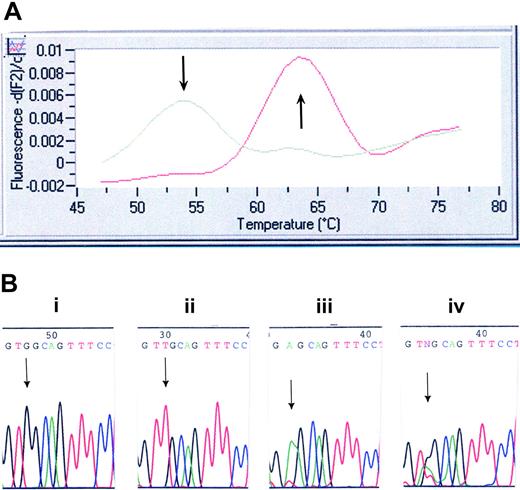 Figure 1. Mutation screening for MPLW515L/K. (A) LightCycler assay for MPLW515L. Melting curve analysis displays that probe bound to a mismatch dissociates at 54°C, whereas probe bound across the wild-type sequence dissociates at 64°C. (B) DNA chromatogram illustrating wild-type MPL515 sequence (i), the TGG→TTG conversion in MPLW515L (ii), the TGG→AAG conversion in MPLW515K (iii), and the presence of all 3 alleles (ie, wild-type MPL, MPLW515L, and MPLW515K) in 2 patients (iv).