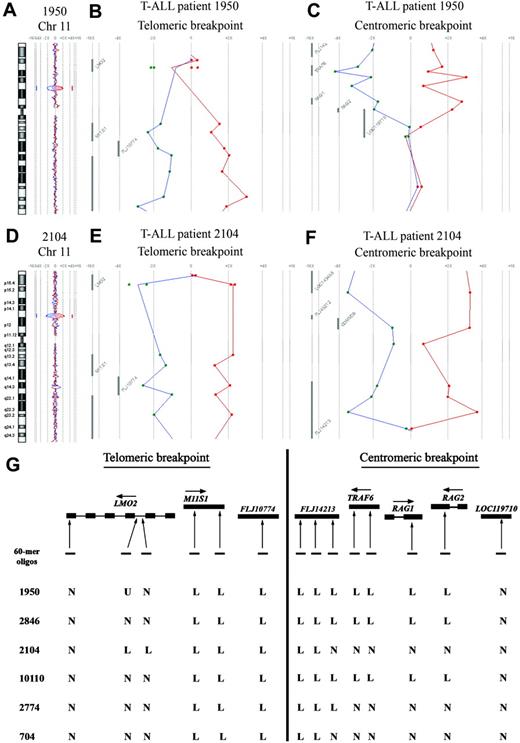 Figure 2. Molecular characterization of deletion, del(11)(p12p13), in 6 pediatric T-ALL patients. Chromosome 11 ideogram and corresponding oligo array-CGH plot of test DNA/control DNA ratios (blue tracing) versus the dye-swap experiment (red tracing) for T-ALL patient 1950 (A) and patient 2104 (D). Hybridization signals in the absence of amplifications or deletions scatter around the “zero” line, indicating equal hybridization for patient and reference DNA. Hybridization signals around the -2X or +2X lines represent loss of the corresponding region in the patient DNA. Detailed analysis of the telomeric breakpoints in patients 1950 (B) and 2104 (E) and the centromeric breakpoints in patients 1950 (C) and 2104 (F) of the deletion, del(11)(p12p13). (G) Overview of oligo array-CGH results in the potential breakpoint regions for 4 DCOG and the 2 COALL T-ALL patients with del(11)(p12p13). The 60-mer oligos present on the DNA array and located in the telomeric and centromeric breakpoint regions, as well as the specific genes located in this region with their transcription direction, are shown. N indicates normal; L, loss; and U, noninformative.