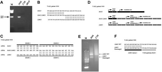 Figure 4. Molecular characterization of del(11)(p12p13) in T-ALL patients 1950 and 2846. (A) Long-range PCR analysis on genomic DNA of patient 1950 using primers situated in intron 1 of RAG2 and intron 1 of LMO2 revealed a specific band of approximately 2000 bp. Patient 2720 served as a negative control. (B) Sequence analysis confirmed the exact position of the genomic breakpoint. (C) PCR analysis on cDNA of this patient revealed a RAG2-LMO2 fusion gene, in which exon 1 of RAG2 was fused to exon 2 of LMO2. (D) Gene (exon) structure of both RAG2 and LMO2 shows that the translation initiation sites are situated in exon 2 and exon 4, respectively. As a consequence, translation of the RAG2-LMO2 fusion gene will also be initiated in exon 4. (E) LM-PCR analysis on HincII-digested genomic DNA from patient 2846 using an LMO2 intron 1-specific primer revealed an aberrant PCR product of approximately 600 bp. The expected wild-type product is approximately 1000 bp and is visible in both patients 2846 and 2720, who served as a negative control. (F) Sequence analysis confirmed that in patient 2846 the LMO2 intron 1 sequences are fused to a genomic region upstream of RAG2. prom indicates promoter.