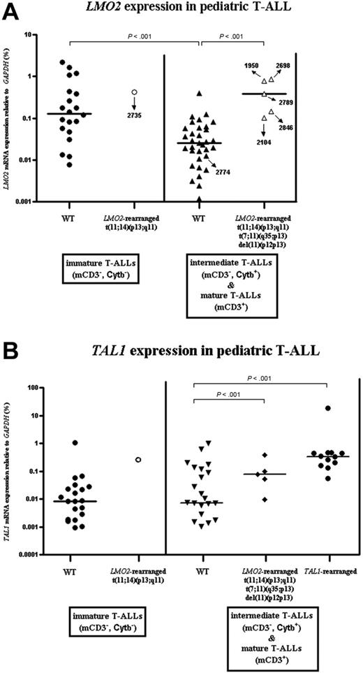 Figure 5. LMO2 and TAL1 expression in pediatric T-ALL. Relative expression levels of LMO2 (A) and TAL1 (B) as percentage of GAPDH expression levels for 59 pediatric T-ALL patients (DCOG cohort). Patients were divided into 2 maturation stages according to their cytoplasmatic TCRβ (Cytβ) and membrane CD3 (mCD3) expression. Median expression levels are indicated by horizontal bars.