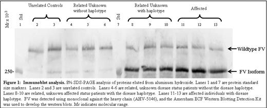 Figure 1:. Immunoblot analysis. 8% SDS-PAGE analysis of proteins eluted from aluminum hydroxide Lanes 1 and 7 are protein standard size markers. Lanes 2 and 3 are unrelated controls. Lanes 4–6 are related, unknown disease status patients without the disease haplotype. Lanes 8–10 are related, unknown affected status patients with the disease haplotype. Lanes 11–13 are affected individuals with disease haplotype. FV was detected using monolconal against the heavy chain (AHV-5146), and the Arnerrham ECF Western Blotting Detection Kit was used to develop the western blots. Mr indicates molecular range.