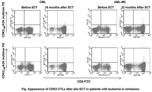 Fig. Appearance of CDK2-CTLs after allo SCT in patients with leukemia in remission.