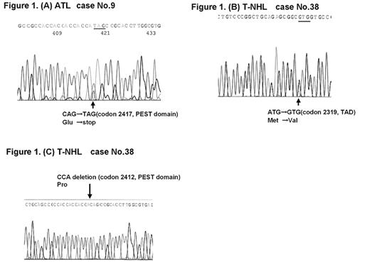 Figure 1. (A) ATL case No.9, (B) T-NHL case No.38, (C) T-NHL case No.38