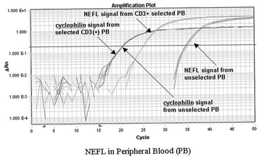 NEFL in Peripheral Blood (PB)