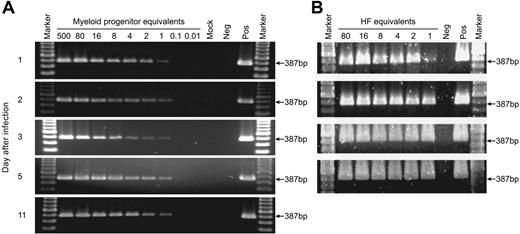Figure 2. Cell-dilution PCR across a time course of infection of myeloid progenitor cells or HFs. Lysates of myeloid progenitor cells or HFs harvested on days 1, 2, 3, 5, and 11 after infection were diluted, and were analyzed by PCR with primers IEP3C and IEP4BII. The position of the 387-bp product derived from HCMV genomic DNA is indicated by arrows. Samples from either mock-infected myeloid progenitor cell cultures or HFs (Mock), productively infected HFs (Pos), or samples without any added DNA template (Neg) were included as controls. Marker was GeneRuler DNA ladder mix (Fermentas, Burlington, ON, Canada).