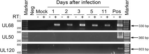 Figure 6. Confirmation of the presence or absence of HCMV gene expression in myeloid progenitors by RT-PCR. RNA extracted from myeloid progenitors on days 1, 2, 3, 5, and 11 after infection was examined by RT-PCR for the expression of UL68, UL50, and UL120 transcripts for 40 cycles of amplication. Controls included the omission of reverse transcriptase (RT), samples from either mock-infected myeloid progenitor cells or HFs (Mock), productively infected HFs (Pos), or samples without any added template (Neg). Marker was GeneRuler DNA ladder mix (Fermentas).