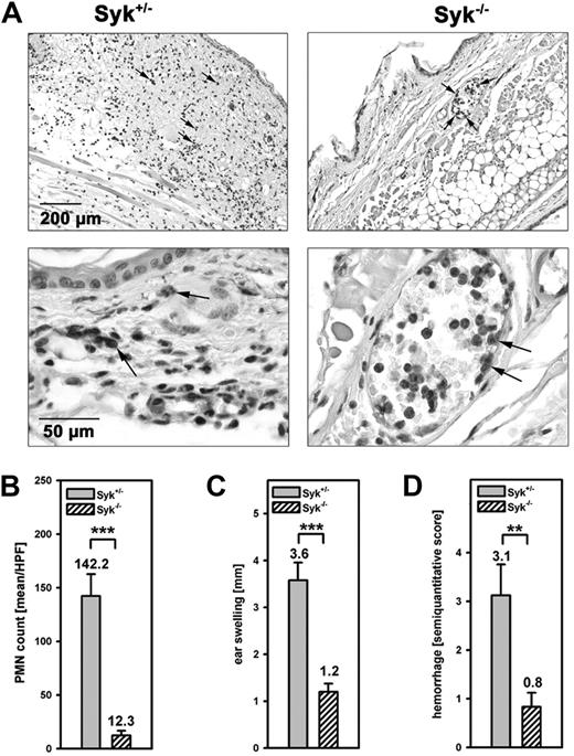 Figure 6. A role of Syk in the acute inflammatory response. The reverse-passive Arthus reaction was induced in the left ear of Syk+/– and Syk–/– bone marrow chimeric mice for 6 hours. (A) Gr-1 staining of PMNs (arrow) in histologic sections of the left ear. (B) PMN extravasation was determined by counting Gr-1+ cells within 6 hours after treatment in 5 different microscopic fields of every section. (C) Edema formation was measured as ear swelling 6 hours after treatment. (D) Semiquantitative score for hemorrhage 6 hours after treatment. n = 4 (Syk+/– animals); n = 3 (Syk–/– animals). Means ± SD are shown. **P < .002; ***P < .001.