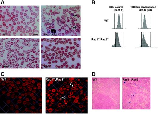 Figure 2. Abnormal morphology of Rac1–/–;Rac2–/– erythrocytes. (A) Wright-Giemsa staining of blood smears of WT, Rac1–/–, Rac2–/–, and Rac1–/–;Rac2–/– mice. Rac1–/– and Rac2–/– blood smears show mild poikilocytosis and anisocytosis. The Rac1–/–;Rac2–/– blood smear demonstrates severe poikilocytosis; arrows indicate the presence of hypochromia (1), polychromasia (2), and fragmented cells (3). Scale bar represents 10 μm. (B) RBC volume and hemoglobin concentration histograms obtained by automated complete blood count analysis of WT and Rac1–/–;Rac2–/– whole blood with an Advia Hematology Analyzer (images representative of 6 samples tested for each genotype). (C) Three-dimensional reconstruction of glutaraldehyde-fixed erythrocyte images. Images were obtained with a × 100 oil-immersed objective lens, numerical aperture 1.45. Arrows show Rac1–/–;Rac2–/– erythrocytes with thinned appearance especially at the central area (1), and a high frequency of bizarre microspherocytes with punctuate lesions (2). One unit represents 9.2 μm. (D) Increased iron deposits in the spleen of Rac1–/–;Rac2–/– mice compared with WT. Scale bar represents 100 μm.