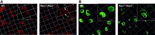Figure 4. Cytoskeleton structure of Rac1–/–;Rac2–/– erythrocytes. (A) Erythrocytes fixed with acrolein and stained with rhodamine-phalloidin for F-actin. Arrowheads in magnified inset show meshwork gaps and aggregates of F-actin in Rac1–/–;Rac2–/– erythrocytes. (B) RBCs stained with anti–band 3 antibody to visualize band 3 distribution. Images were obtained with a × 63 oil-immersed objective lens, software zoom × 2, numerical aperture 1.4; 1 unit represents 7.3 μm.