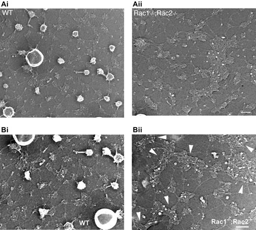 Figure 5. Organization of the membrane skeletons of WT and Rac1–/–;Rac2–/– erythrocytes. Micrographs of representative metal cast of a WT and a Rac1–/–;Rac2–/– unroofed erythrocyte. (A) The membrane skeleton of the WT erythrocyte is composed of a uniform lattice of interconnected strands, as previously reported.36 Rac1–/–;Rac2–/– membrane skeletons revealed irregularity of the hexagonal spectrin scaffold and a paucity of membrane “endovesiculations.” Scale bar represents 100 nm. (B) In higher magnification, the arrowheads point to large clusters in the Rac1–/–;Rac2–/– cytoskeleton that appear to have the same “globular” consistency with the junctions in the WT cytoskeleton. Scale bar represents 100 nm.