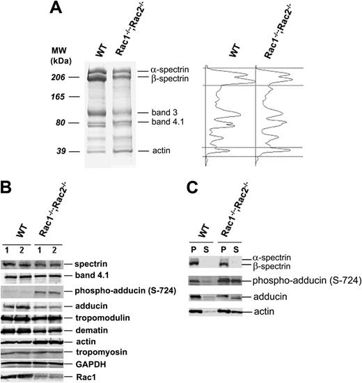 Figure 6. Erythrocyte protein and phosphorylation profile in Rac1–/–;Rac2–/– RBCs evaluated in SDS-polyacrylamide gels. (A) RBC ghost electrophoretic pattern in Rac1–/–;Rac2–/– versus WT erythrocytes. Molecular weight markers and major RBC cytoskeleton proteins are indicated. Densitometry scans of the 2 lanes, respectively, are shown on the right with spectrin and actin bands noted between the dotted lines. The actin-to-spectrin ratio was reproducibly 2 to 3 times higher in the Rac1–/–;Rac2–/– ghosts versus the WT ghosts. (B) Profile of the major actin-interacting proteins and serine phosphorylation of adducin in WT and Rac1–/–;Rac2–/– erythrocytes (2 μL packed RBCs loaded/lane). Two different samples from each genotype are shown. (C) Triton-soluble (S) and pellet (P) fractions of erythrocyte ghosts evaluated by immunoblotting for the presence of spectrin, adducin, actin, and phospho-adducin (Ser724). All images are representative of at least 6 different blood samples from each genotype.