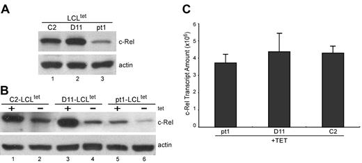 Figure 4. Detection of reduced c-Rel protein expression that is not related to transcript levels. (A) Protein expression of c-Rel. Whole-cell lysate from LCLtet cells, cultured in the presence of tet, was analyzed by Western blot and probed with antibodies against c-Rel and actin, which served as an internal loading control. (B) Nuclear translocation of c-Rel with LMP1 stimulation. Nuclear extract from LCLtet cells, cultured in the presence (+tet) or absence (–tet) of LMP1 was also analyzed for c-Rel expression by immunoblot. (C) Relative transcript levels of c-Rel. RNA from pt1 and control LCLtet cells was reverse-transcribed and analyzed by qPCR with probes specific for c-Rel. Results are expressed as relative transcript amounts and standard deviation of 2 independent experiments.