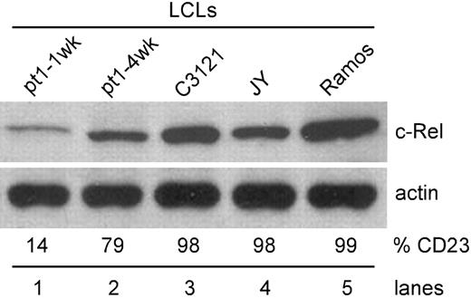 Figure 5. Up-regulation of CD23 enhances c-Rel expression. Using established LCLs, whole-cell lysate was analyzed for c-Rel expression by Western blot. Pt1-1wk LCLs were cultured for 1 week and pt1-4wk LCLs, with a lymphoblastic phenotype, were cultured for 4 weeks prior to analysis. C3121 and JY are EBV positive, and Ramos is an EBV-negative B-cell line. Cell surface expression of CD23 (%CD23) was also examined by flow cytometry. Values represent percent positive cells.
