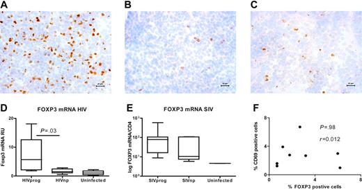 Figure 1. Low expression of FOXP3 in LT from HIVnp and SIVnp. (A-C) Photomicrograph of FOXP3 protein–expressing cells (brown) in LT from a representative HIVprog (n = 6) (A), HIVnp (n = 5) (B), and uninfected individual (n = 5) (C). Cell nuclei were counterstained in blue; the micron bar in bottom right corner indicates 20 μm. Images were acquired using a Leica DMR-X microscope coupled to a Leica DC500 digital camera (Leica, Wetzlar, Germany), using the image analysis system Quantimet Q550 (Leica Imaging Systems, Cambridge, United Kingdom). The image was acquired using a 40×/0.75 numerical aperture (NA) oil objective. The staining reactions were developed using diaminobenzidine tetrahydrochloride and hematoxylin. (D) FOXP3 mRNA expression was significantly decreased in LT of HIVnp. Results are expressed in RU after normalization on CD4 mRNA. Similar results were obtained when FOXP3 was normalized on GAPDH expression (P = .004, not shown). Horizontal bars within boxes correspond to the median; box limits correspond to the 25th and 75th percentiles; vertical lines indicate range. (E) Median FOXP3 mRNA expression was decreased in LT from 7 SIVnps, compared with that in 7 SIVprogs. Results are expressed in RU after normalization on CD4 mRNA. (F) Percentages of CD69+ and FoxP3+ cells were not correlated in LT of HIV-infected individuals (r = 0.012, P = .98; Spearman correlation).