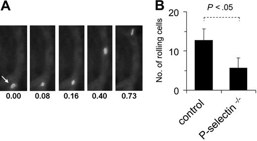 Figure 6. MSCs interact with endothelium in vivo. MSCs (passages 6-9) were fluorescence-marked with PKH-26 as described in “Materials and methods,” injected intra-arterially into wild-type or P-selectin–/– mice and followed microscopically in an ear window. (A) Representative views of a fluorescing cell, rolling on a microvessel. Numbers represent time points in seconds after start of analysis. (B) The rolling fraction of all cells in murine skin postcapillary venules was calculated after video microscopic analysis in and MSCs. Values are means ± SD from 9 vessels/3 animals analyzed in wild-type mice and 6 vessels/2 animals analyzed in P-selectin–deficient mice.
